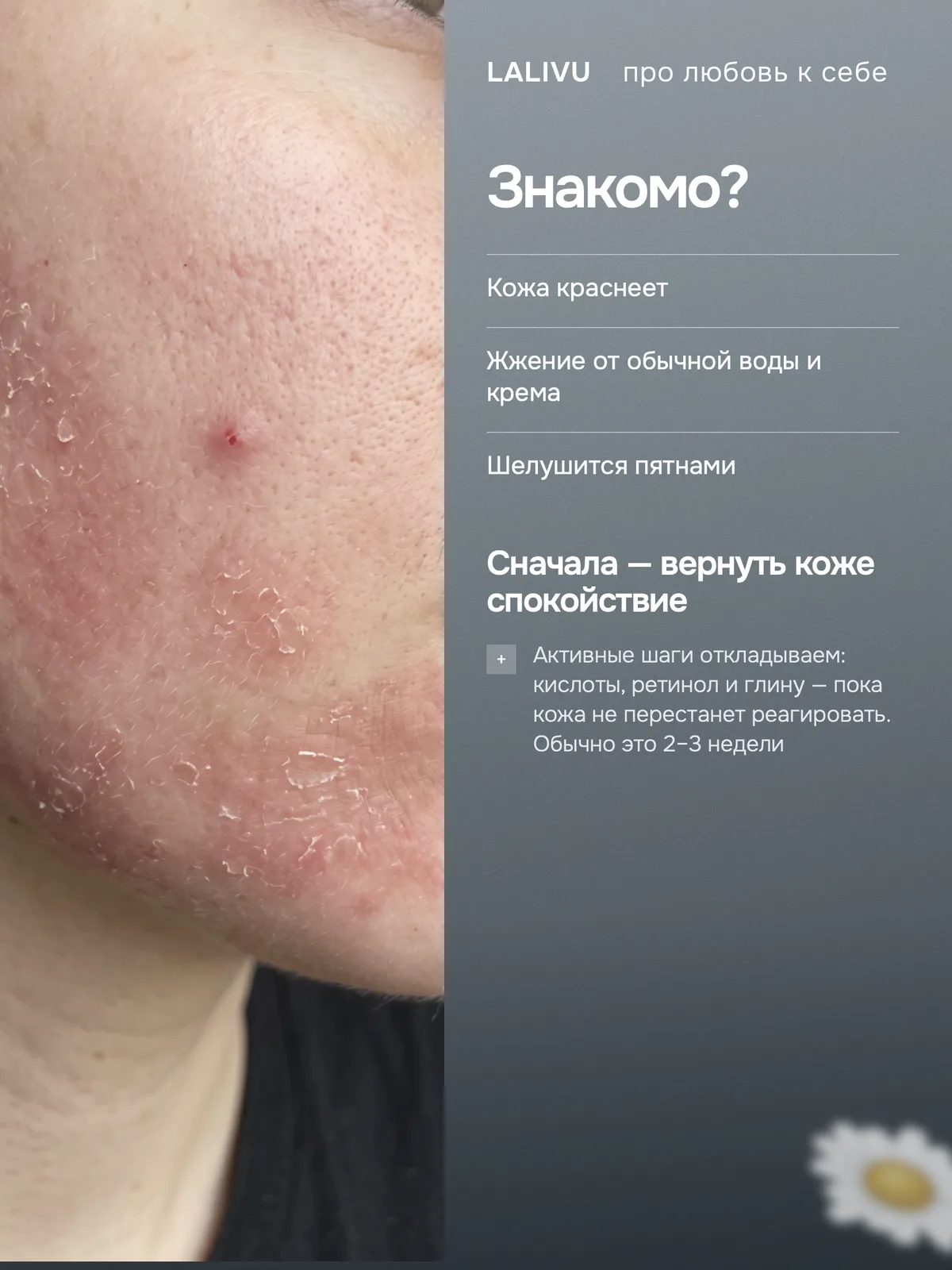 Набор  для чувствительной и реактивной кожи — фото 2